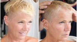 A apresentadora compartilha como a alopecia androgenética afeta sua autoestima e os tratamentos disponíveis para a alopecia feminina Créditos: Reprodução Instagram / Internet