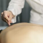 A acupuntura auxilia no tratamento da fibromialgia
