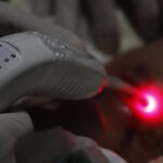 A laserterapia proporciona um alívio imediato graças às suas capacidades analgésicas, anti inflamatórias e cicatrizantes