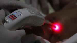 A laserterapia proporciona um alívio imediato graças às suas capacidades analgésicas, anti inflamatórias e cicatrizantes