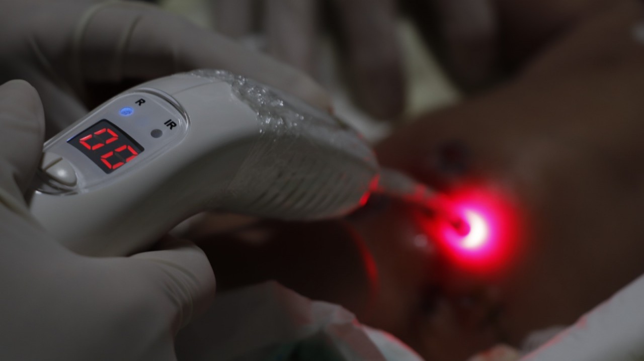 Conheça os benefícios da laserterapia
