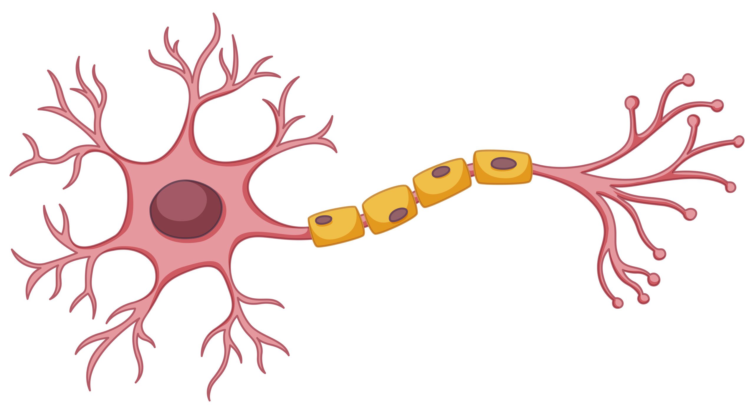 Quem tem aneurisma cerebral pode praticar atividade física?