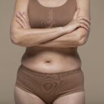 Embora frequentemente associada a uma questão estética, a diástase também compromete a saúde