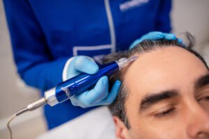 Xô, calvície! Cinco dicas para fortalecer o crescimento capilar