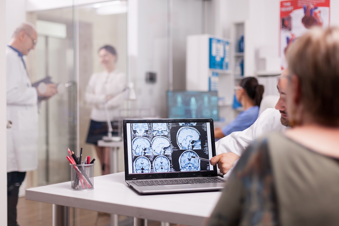 Aneurisma cerebral é silencioso e pode ser fatal