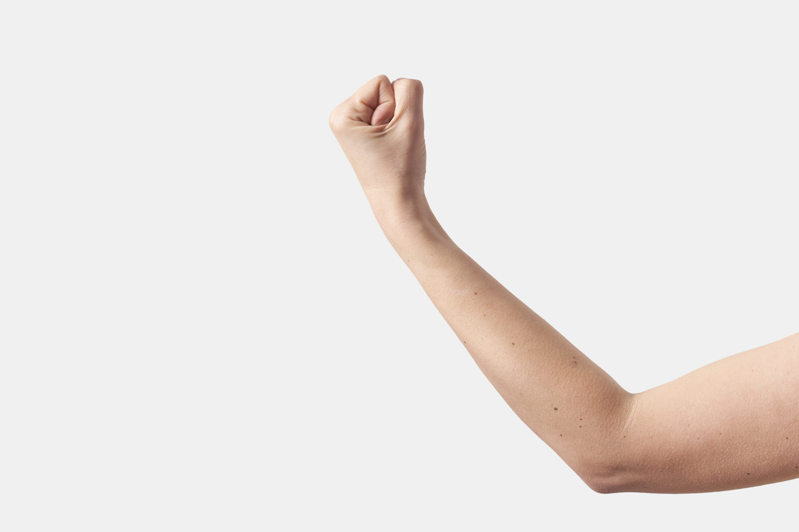Da tradição à inovação: o papel renovado dos implantes hormonais