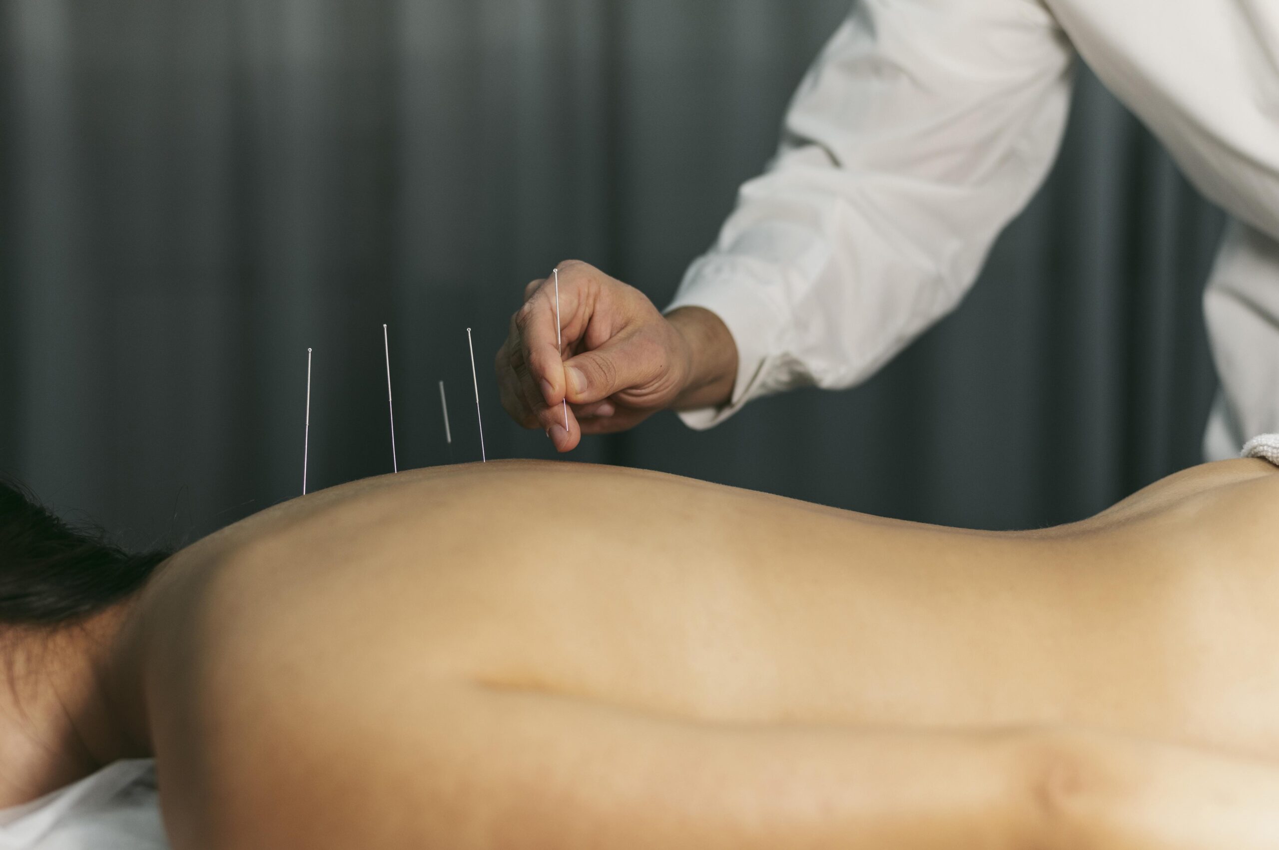 Como a acupuntura trata os sintomas relacionados ao estresse