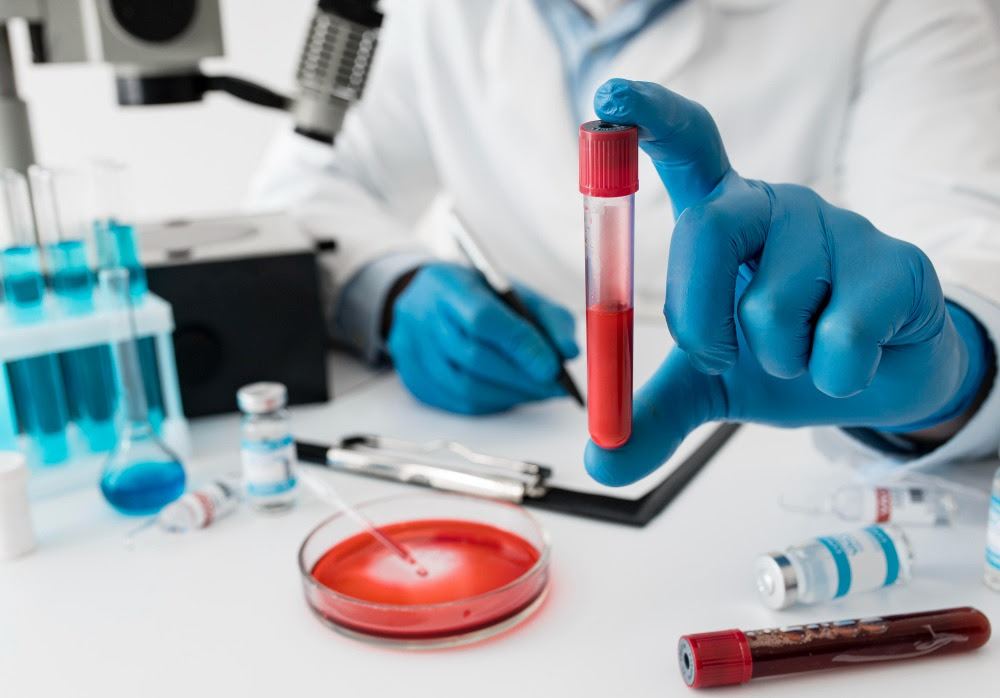 Leucemia: Diagnóstico precoce ajuda a identificar a doença