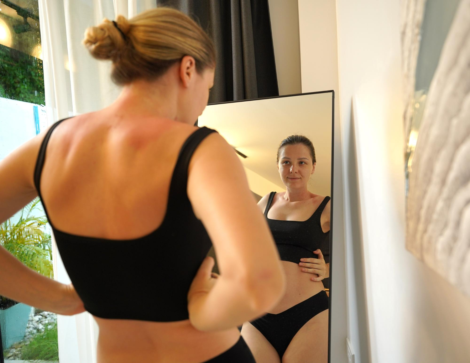 Pós-bariátrica: cirurgia reparadora é necessidade ou capricho?