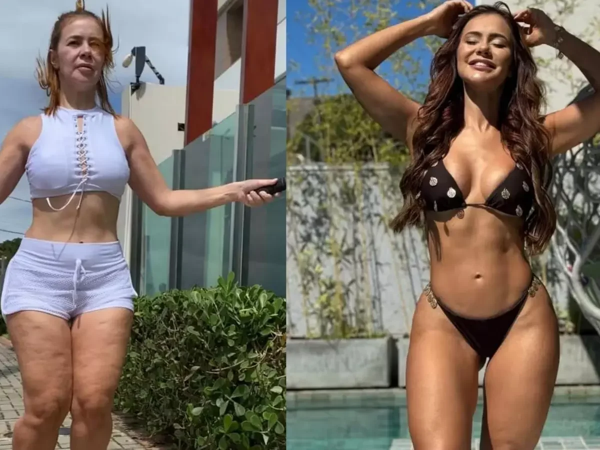 Mirela Janis fala sobre sua luta com lipedema