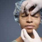 O poder da cirurgia plástica além da estética