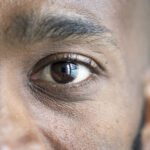 Abril Marrom: 80% dos casos de cegueira poderiam ser evitados