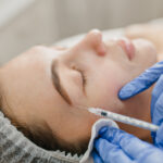 Mitos e verdades sobre baby botox