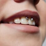 Piercing na boca pode prejudicar dentes e gengivas?
