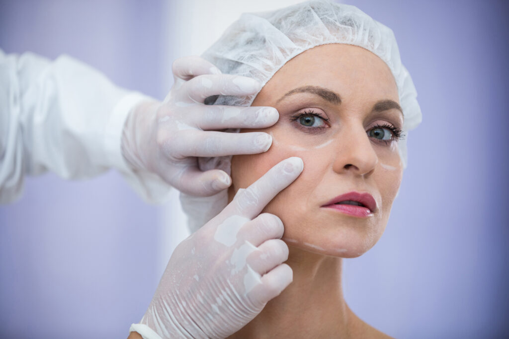 Lifting facial: 7 coisas essenciais para saber antes de fazer